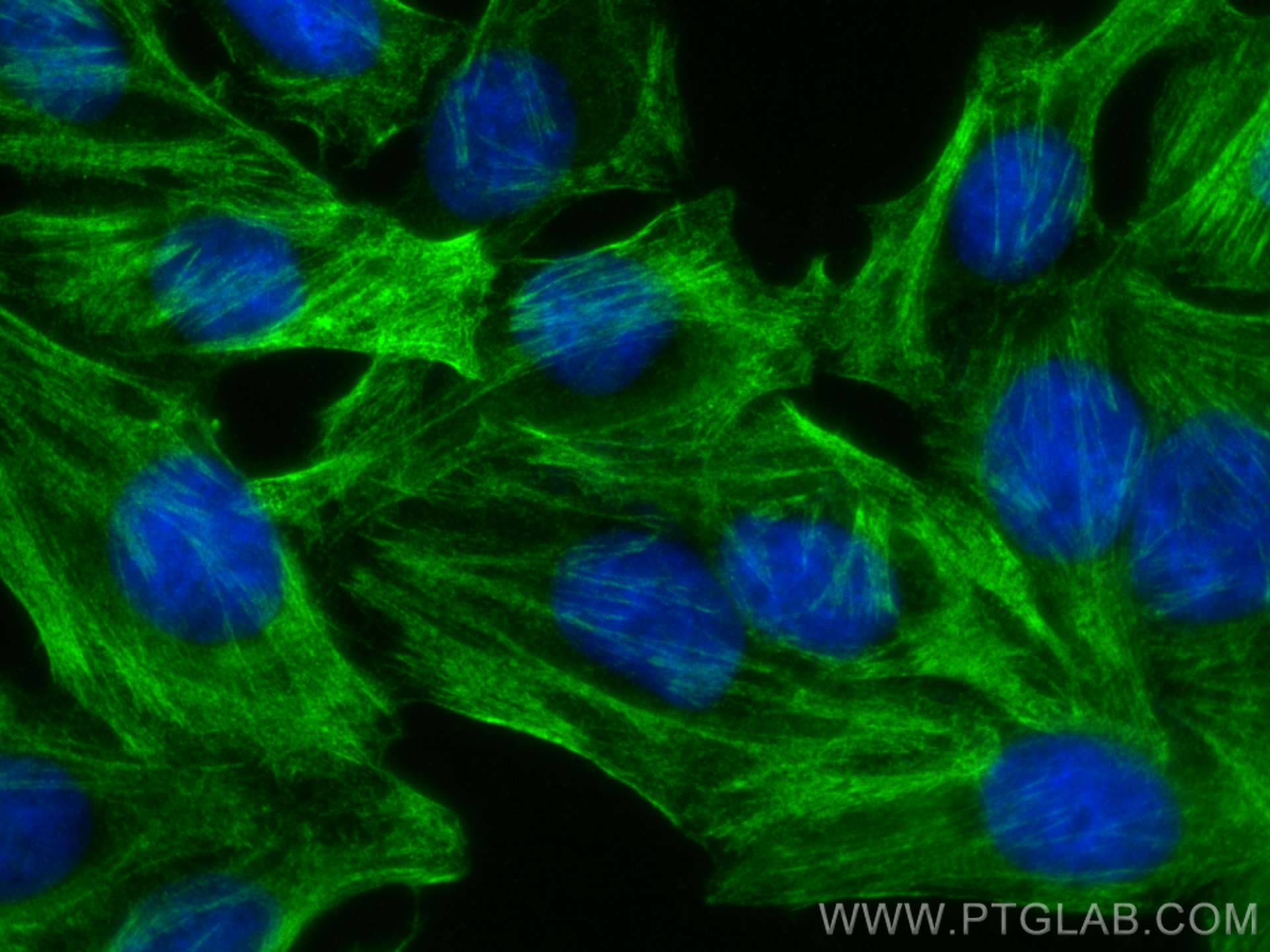 IF Staining of HepG2 using 66693-1-Ig (same clone as 66693-1-PBS)