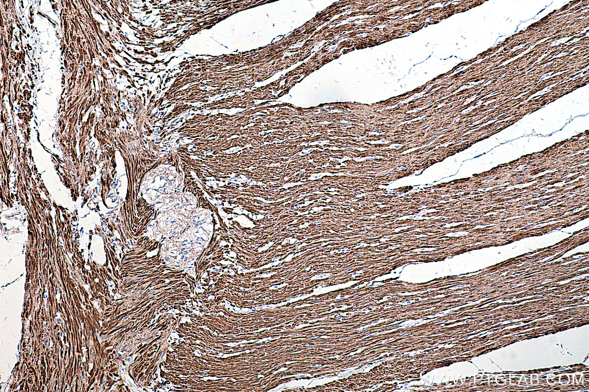 IHC staining of human colon using 66693-1-Ig (same clone as 66693-1-PBS)