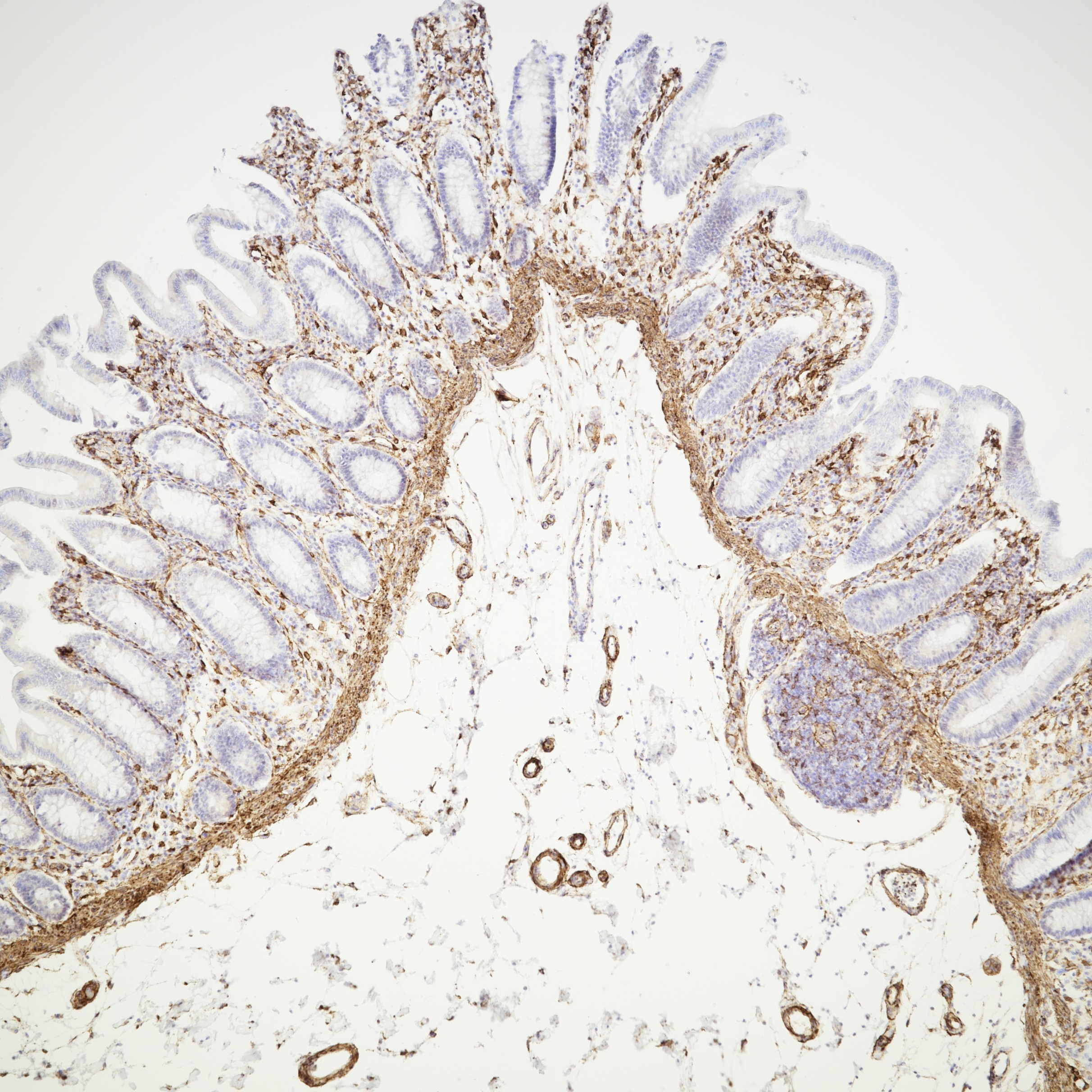 IHC staining of human colon using 66693-1-Ig