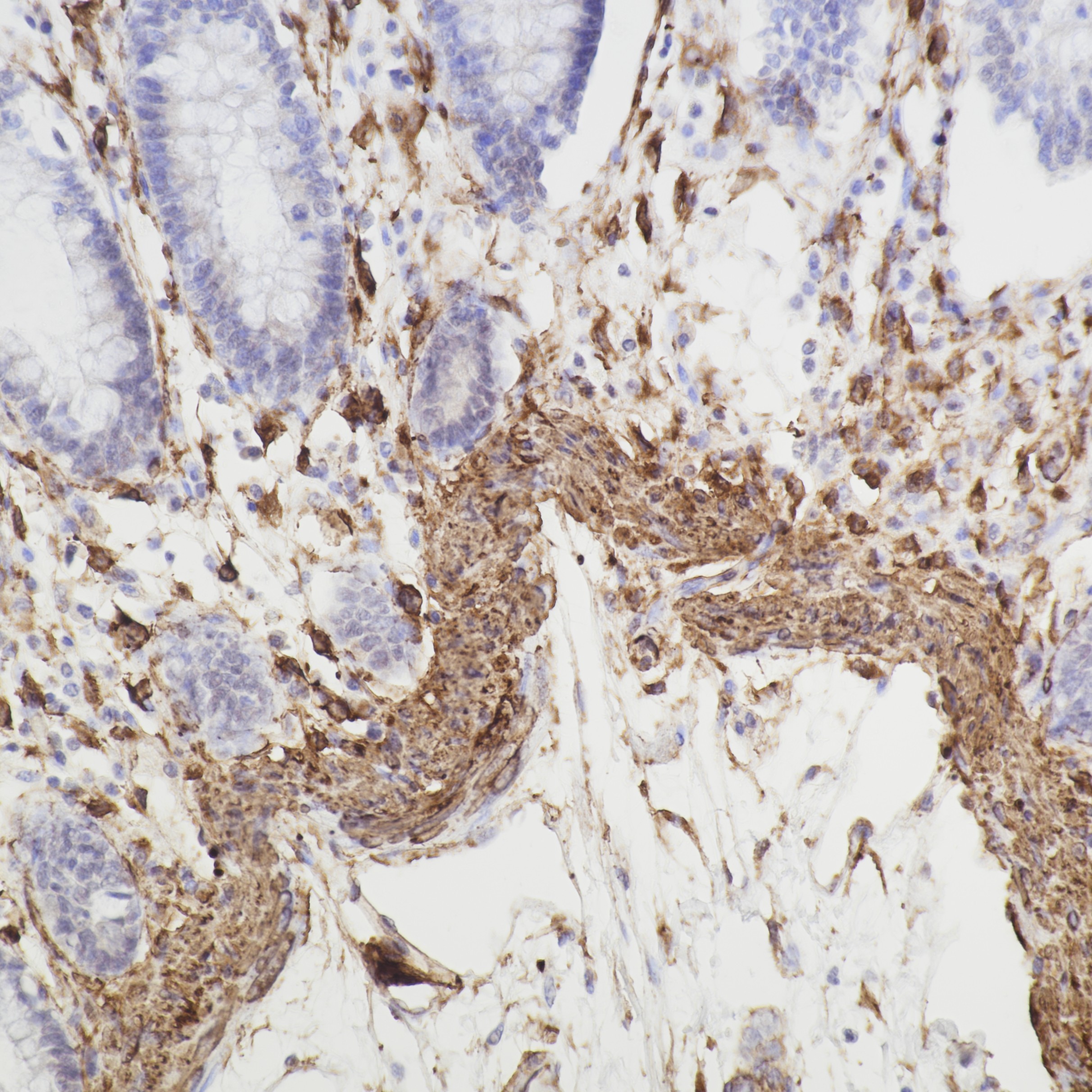 IHC staining of human colon using 66693-1-Ig