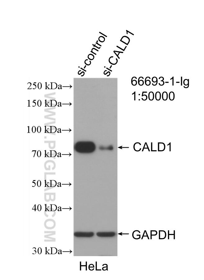 WB analysis of HeLa using 66693-1-Ig (same clone as 66693-1-PBS)