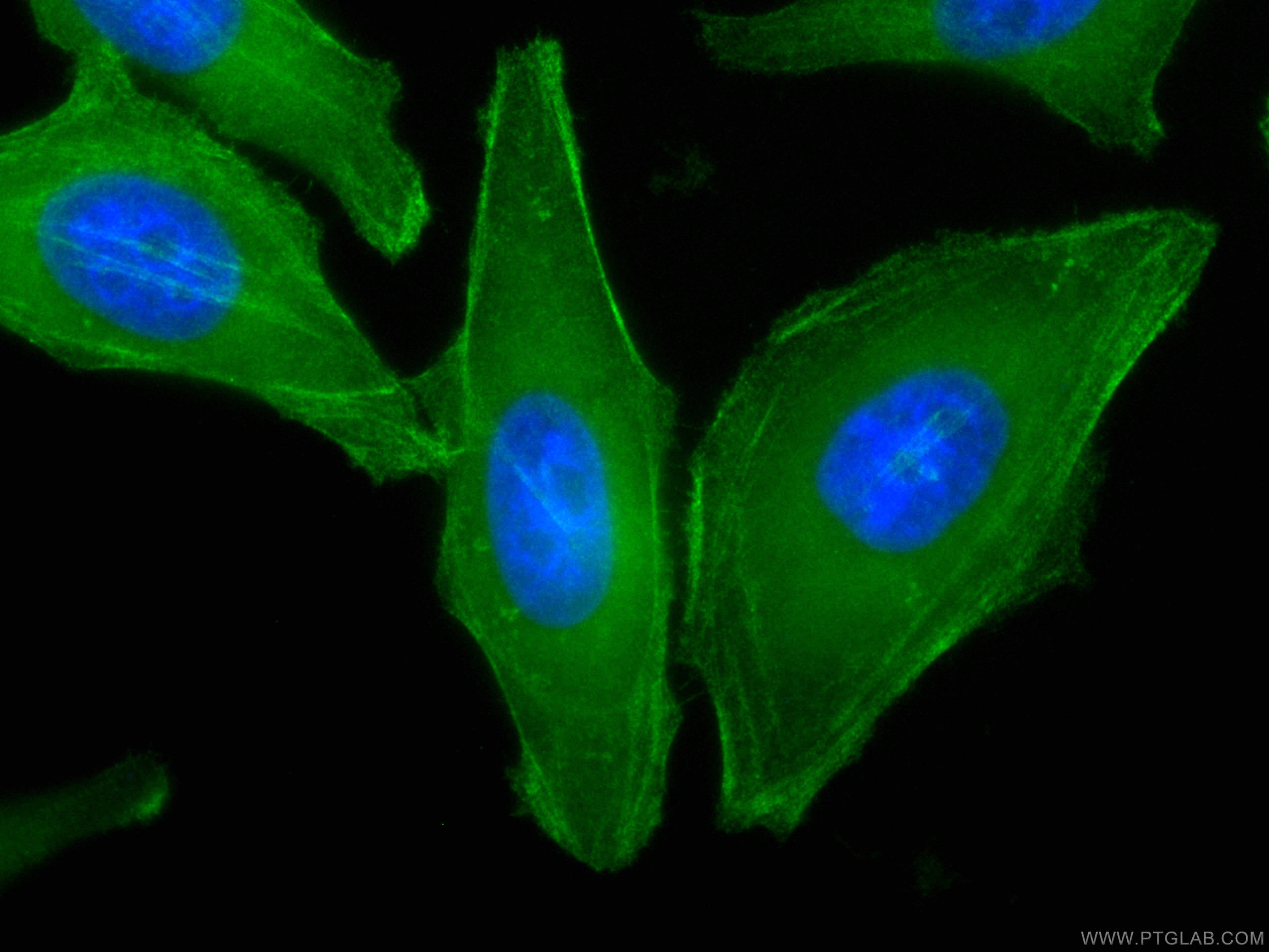 IF Staining of HepG2 using CL488-66693