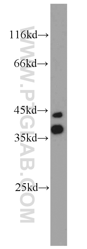 WB analysis of mouse brain using 22042-1-AP