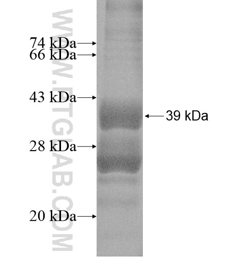 CALHM3 fusion protein Ag14937 SDS-PAGE CALHM3 fusion protein Ag14937 SDS-PAGE