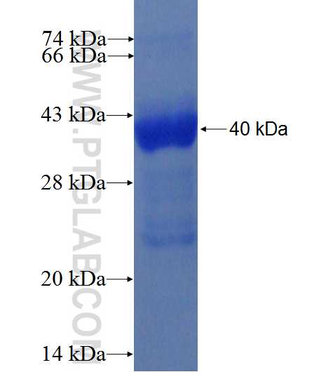 CALM1 fusion protein Ag0490 SDS-PAGE