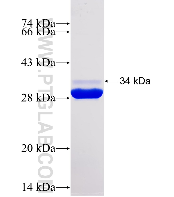 CALM3 fusion protein Ag30467 SDS-PAGE CALM3 fusion protein Ag30467 SDS-PAGE