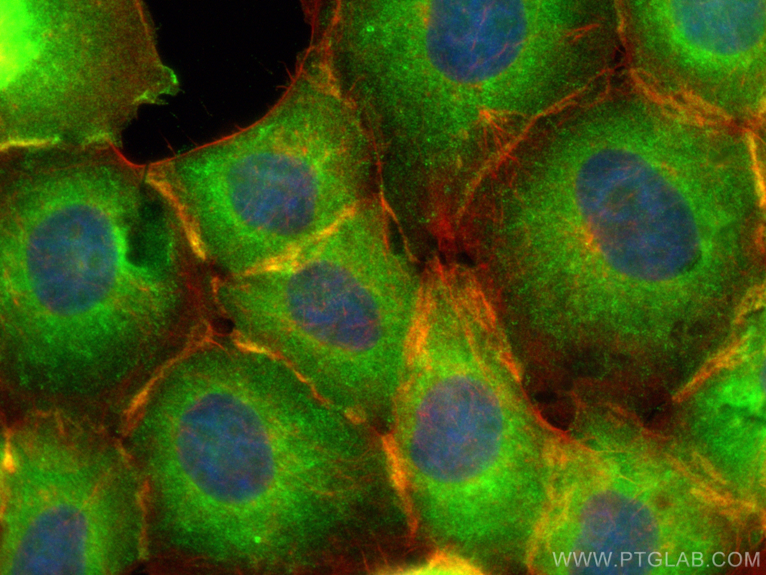 IF Staining of A431 using 17275-1-AP