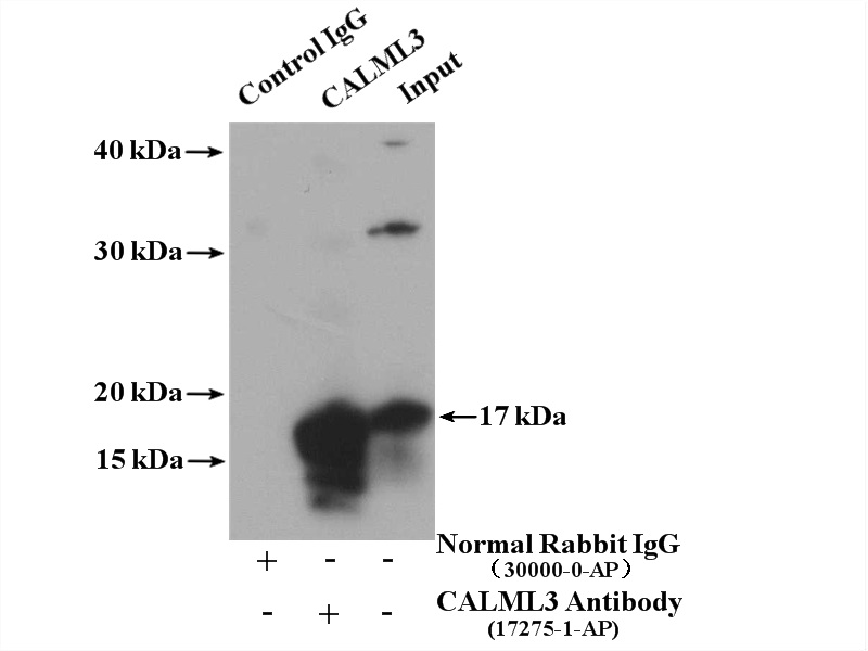 IP experiment of A431 using 17275-1-AP