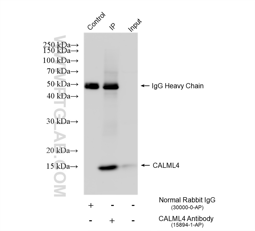 IP experiment of rat kidney using 15894-1-AP IP experiment of rat kidney using 15894-1-AP