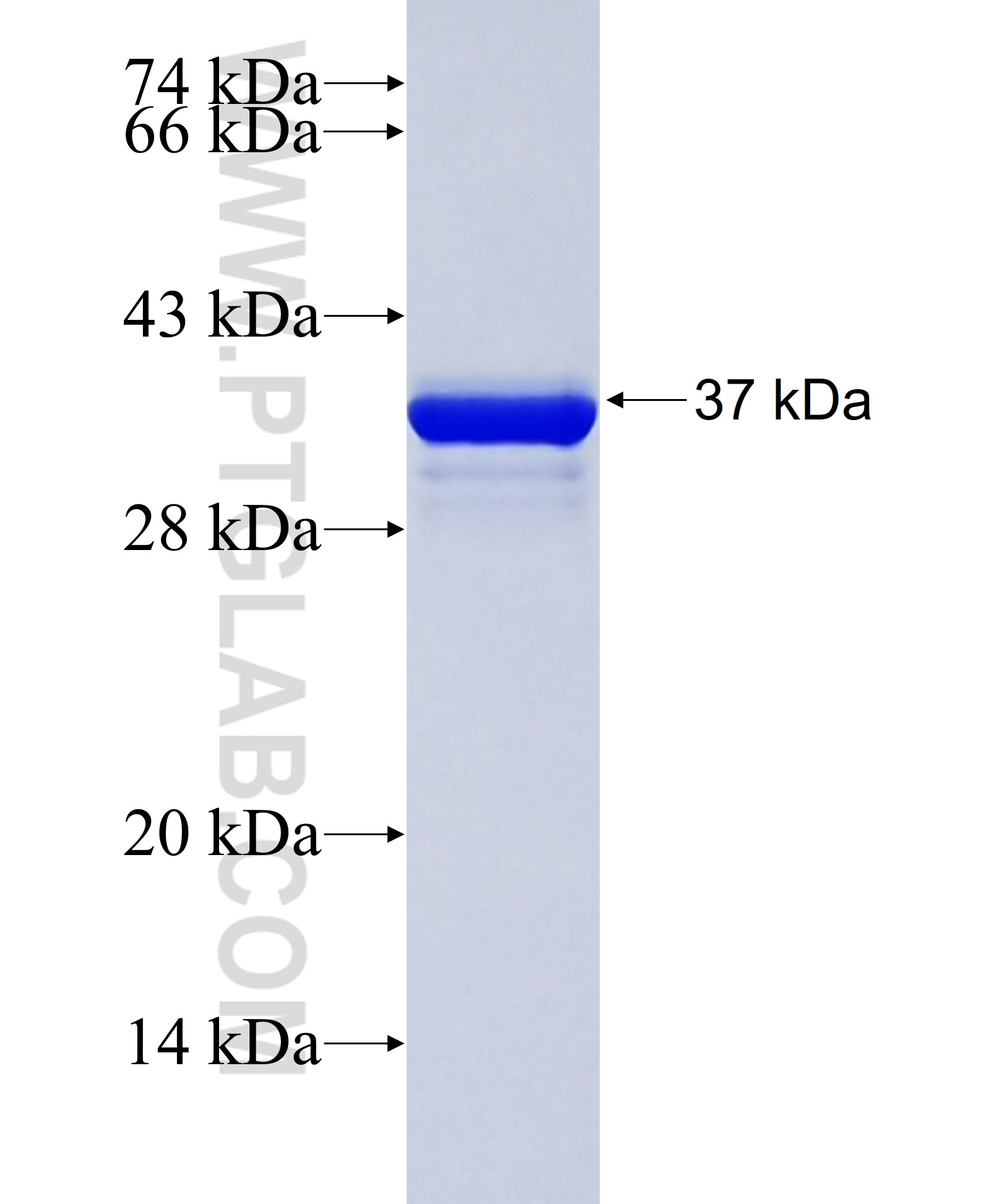 CALML5 fusion protein Ag29716 SDS-PAGE CALML5 fusion protein Ag29716 SDS-PAGE