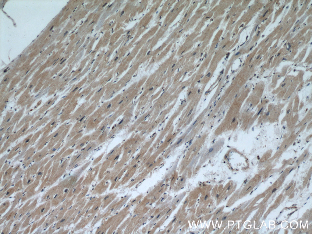 IHC staining of human heart using 22274-1-AP