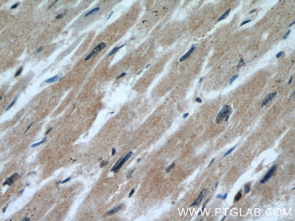 IHC staining of human heart using 22274-1-AP