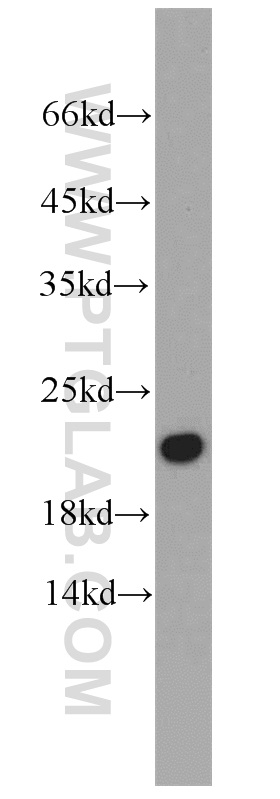 WB analysis of human heart using 22274-1-AP