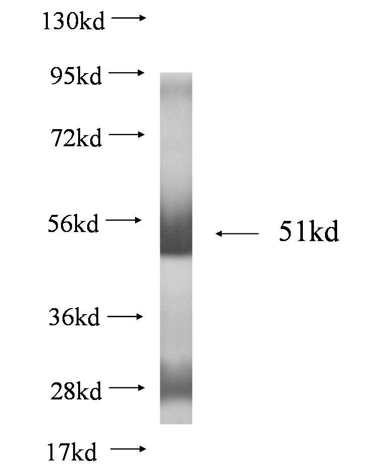 CALN1 fusion protein Ag2043 SDS-PAGE