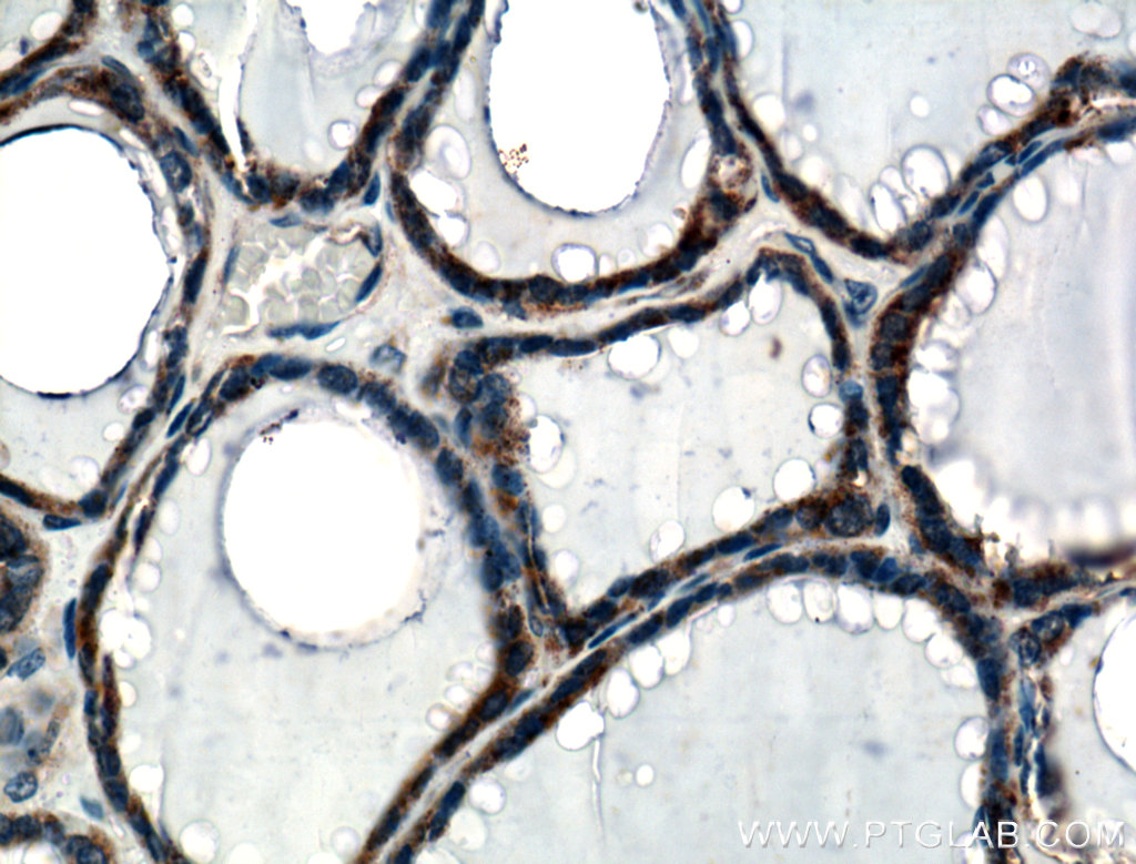 IHC staining of human thyroid using 10292-1-AP