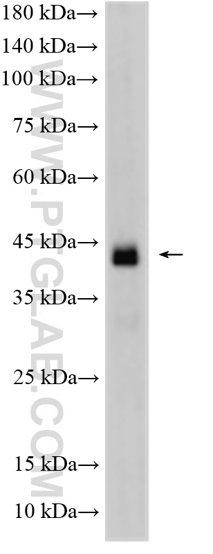 WB analysis of mouse testis using 17064-1-AP WB analysis of mouse testis using 17064-1-AP