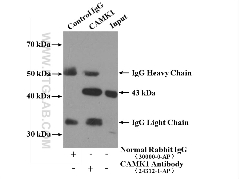 IP experiment of HEK-293 using 24312-1-AP