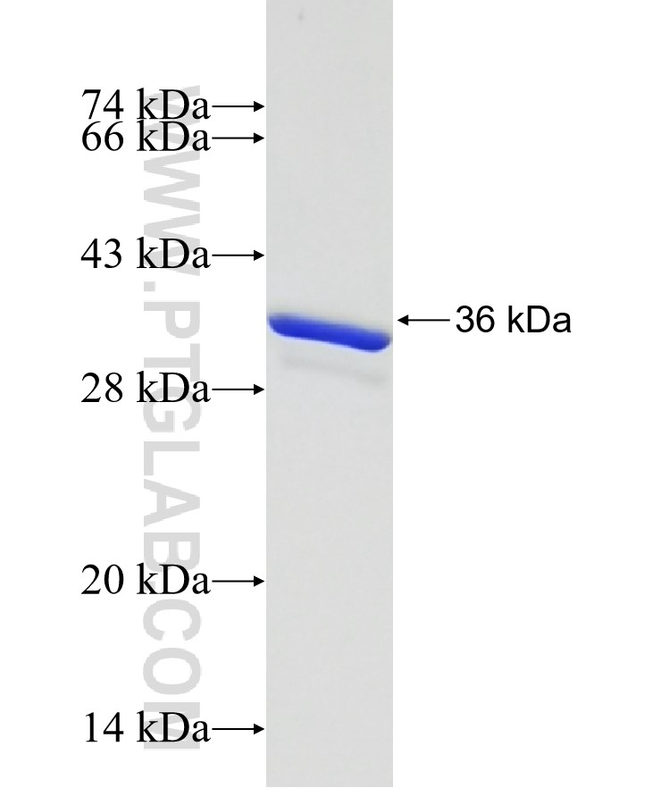 CAMK1 fusion protein Ag19449 SDS-PAGE