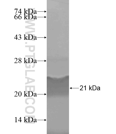 CAMK1 fusion protein Ag19473 SDS-PAGE CAMK1 fusion protein Ag19473 SDS-PAGE