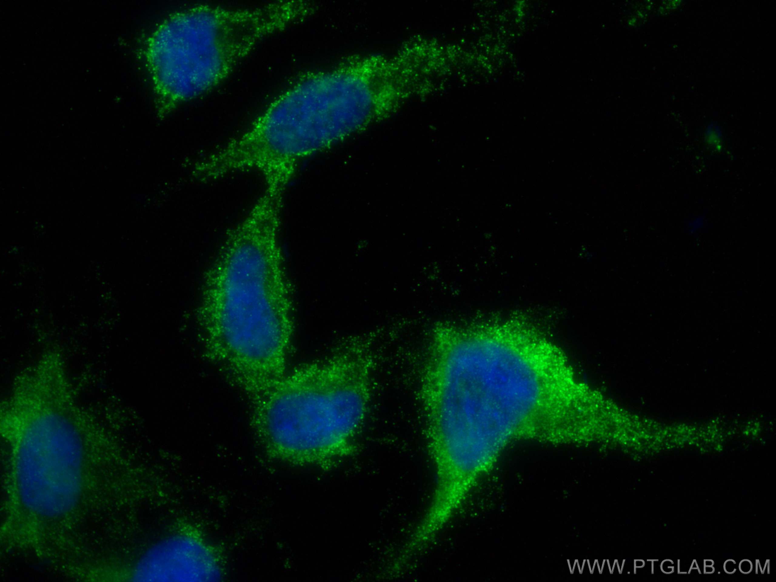 IF Staining of SH-SY5Y using 66843-1-Ig (same clone as 66843-1-PBS)