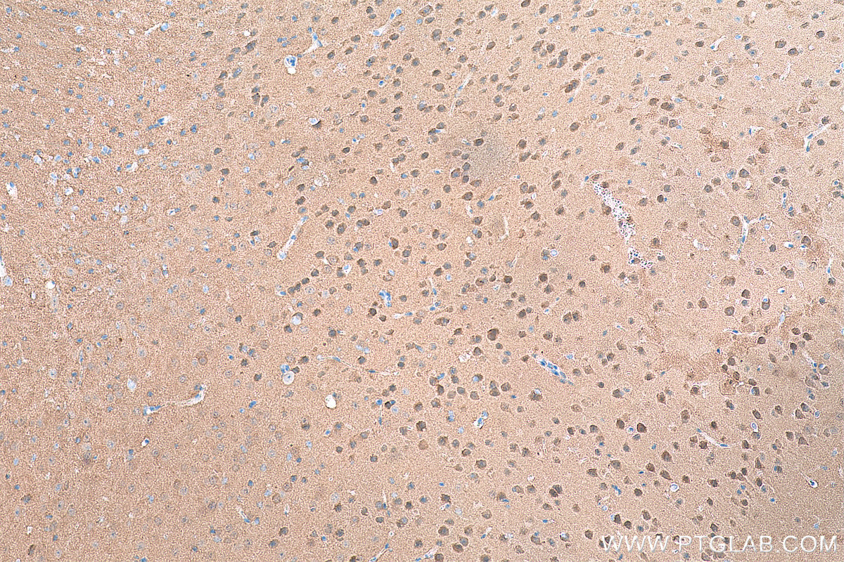 IHC staining of mouse brain using 66843-1-Ig (same clone as 66843-1-PBS)