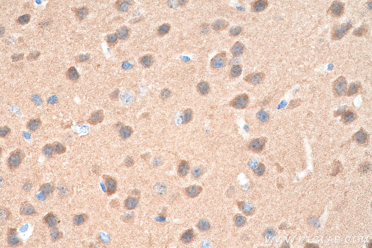 IHC staining of mouse brain using 66843-1-Ig (same clone as 66843-1-PBS)