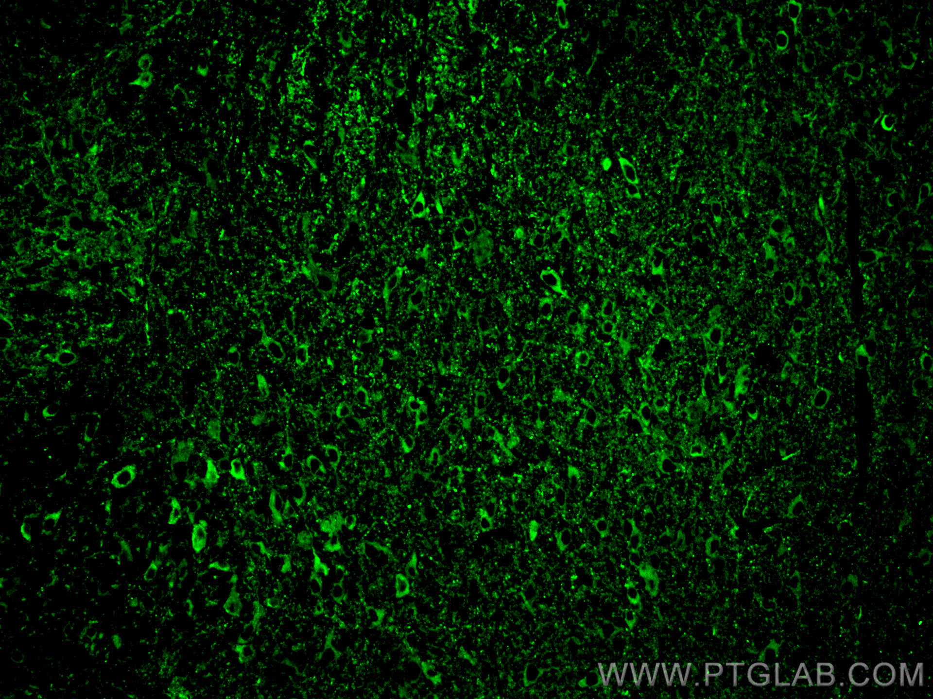 IF Staining of mouse brain using 13730-1-AP