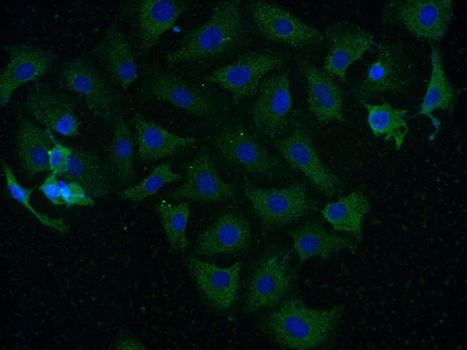 IF Staining of SH-SY5Y using 13730-1-AP
