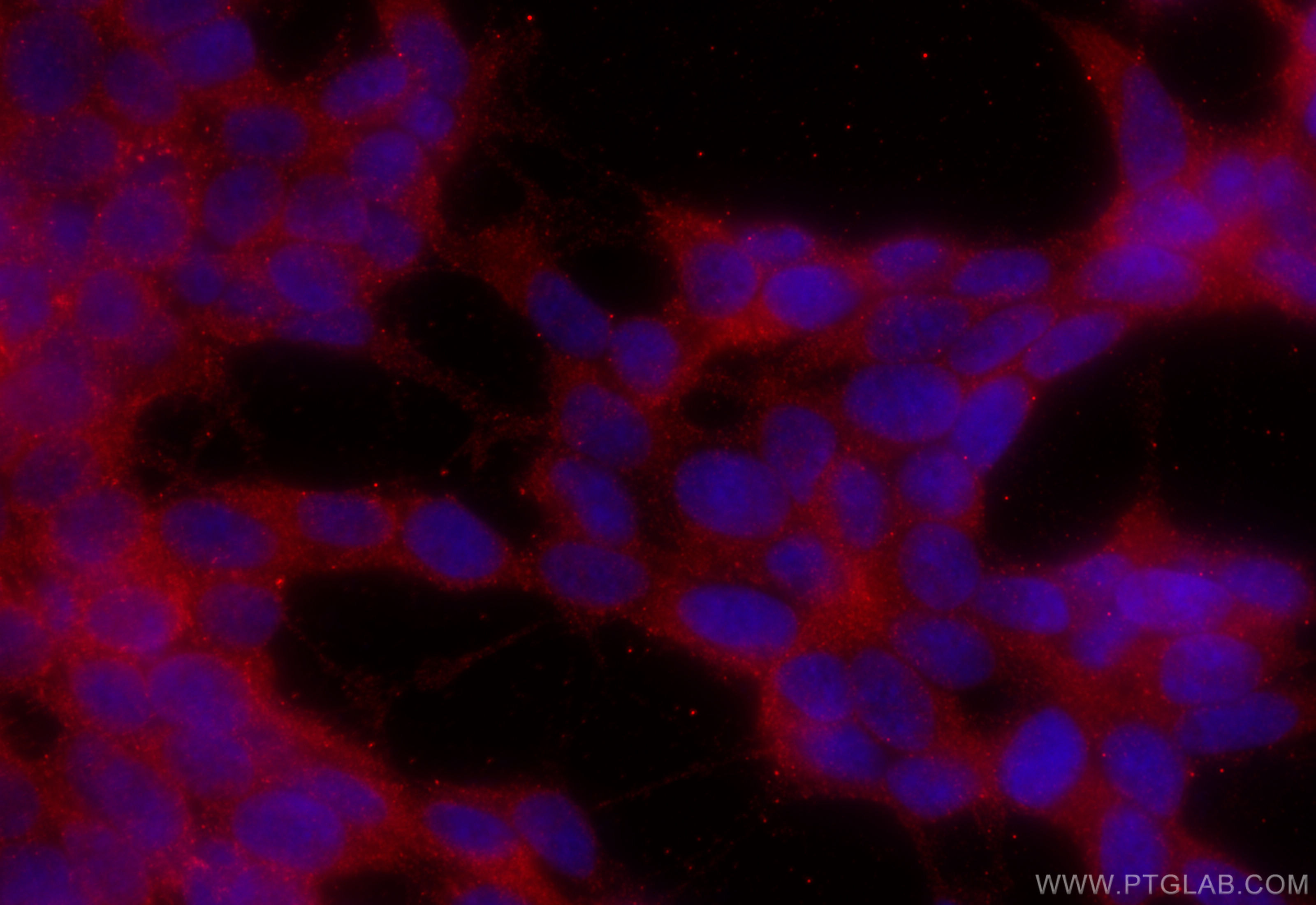 IF Staining of SH-SY5Y using 13730-1-AP