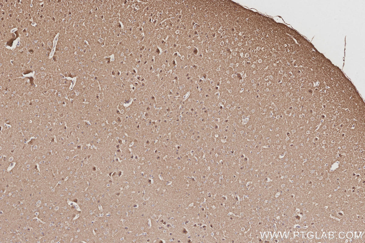 IHC staining of mouse brain using 13730-1-AP