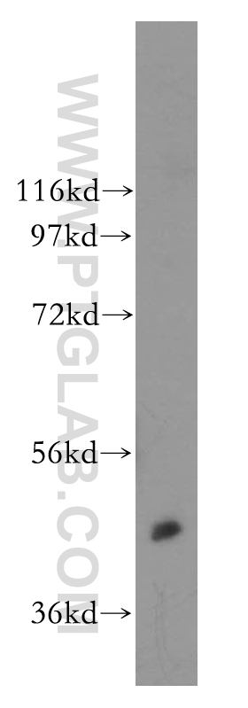 CaMKII alpha