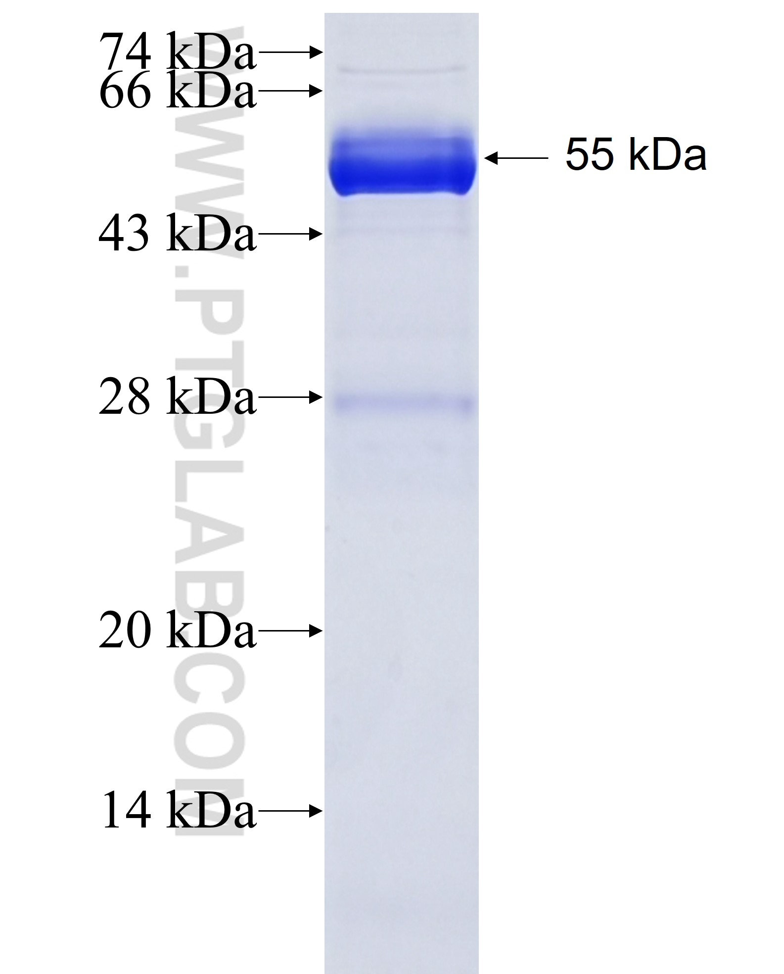 CAMK2A fusion protein Ag4745 SDS-PAGE