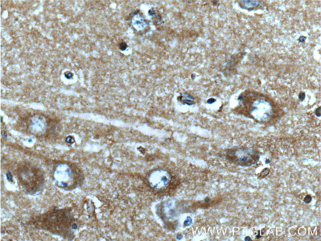 IHC staining of human brain using 20666-1-AP