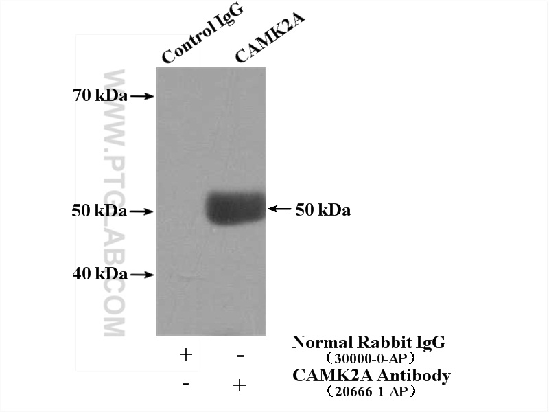 IP experiment of HEK-293 using 20666-1-AP