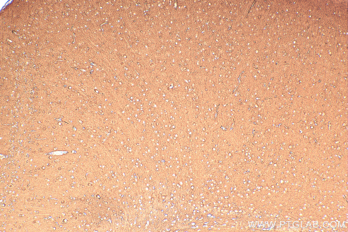 Immunohistochemical analysis of paraffin-embedded mouse brain tissue slide using 11533-1-AP (CAMK2B antibody) at dilution of 1:200 (under 10x lens). Heat mediated antigen retrieval with Tris-EDTA buffer (pH 9.0). IHC staining of mouse brain using 11533-1-AP