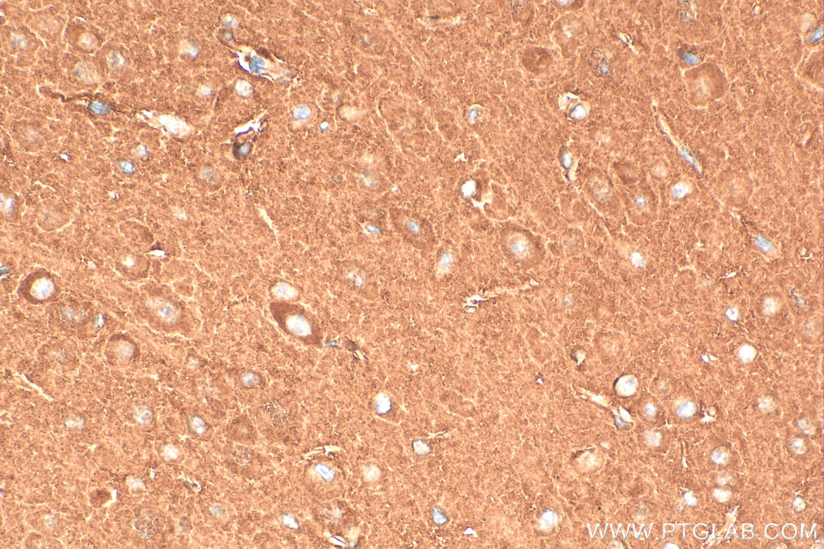 Immunohistochemical analysis of paraffin-embedded mouse brain tissue slide using 11533-1-AP (CAMK2B antibody) at dilution of 1:200 (under 40x lens). Heat mediated antigen retrieval with Tris-EDTA buffer (pH 9.0). IHC staining of mouse brain using 11533-1-AP