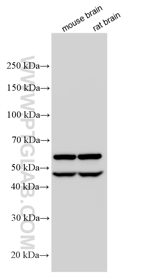 Various lysates were subjected to SDS PAGE followed by western blot with 11533-1-AP (CAMK2B antibody) at dilution of 1:10000 incubated at room temperature for 1.5 hours. WB analysis using 11533-1-AP