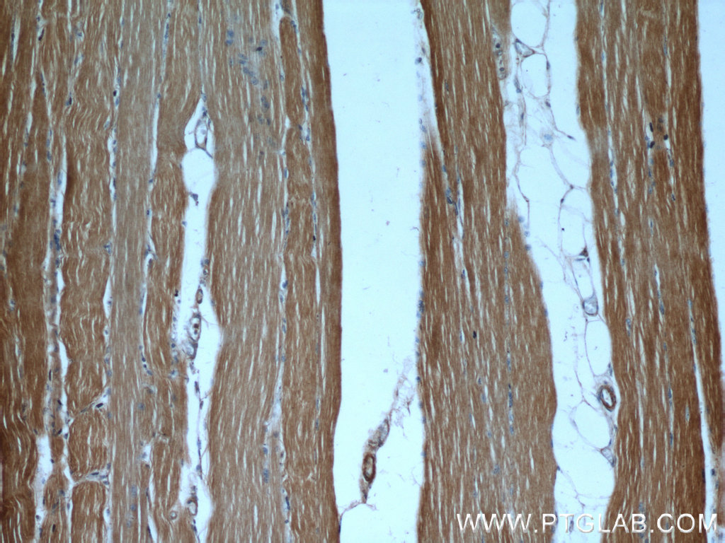 IHC staining of human skeletal muscle using 55218-1-AP