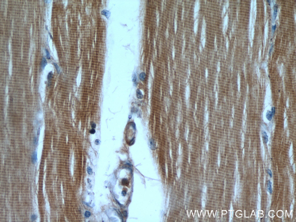 IHC staining of human skeletal muscle using 55218-1-AP