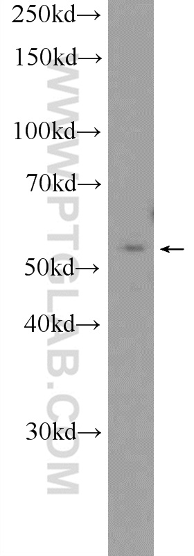 WB analysis of SMMC-7721 using 12666-2-AP (same clone as 12666-2-PBS)