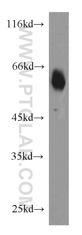 WB analysis of mouse brain using 55140-1-AP