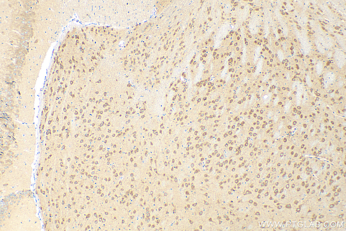 IHC staining of mouse brain using 25313-1-AP