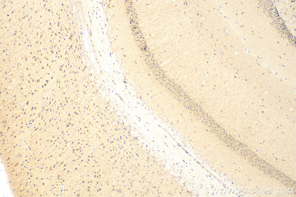IHC staining of mouse brain using 28090-1-AP