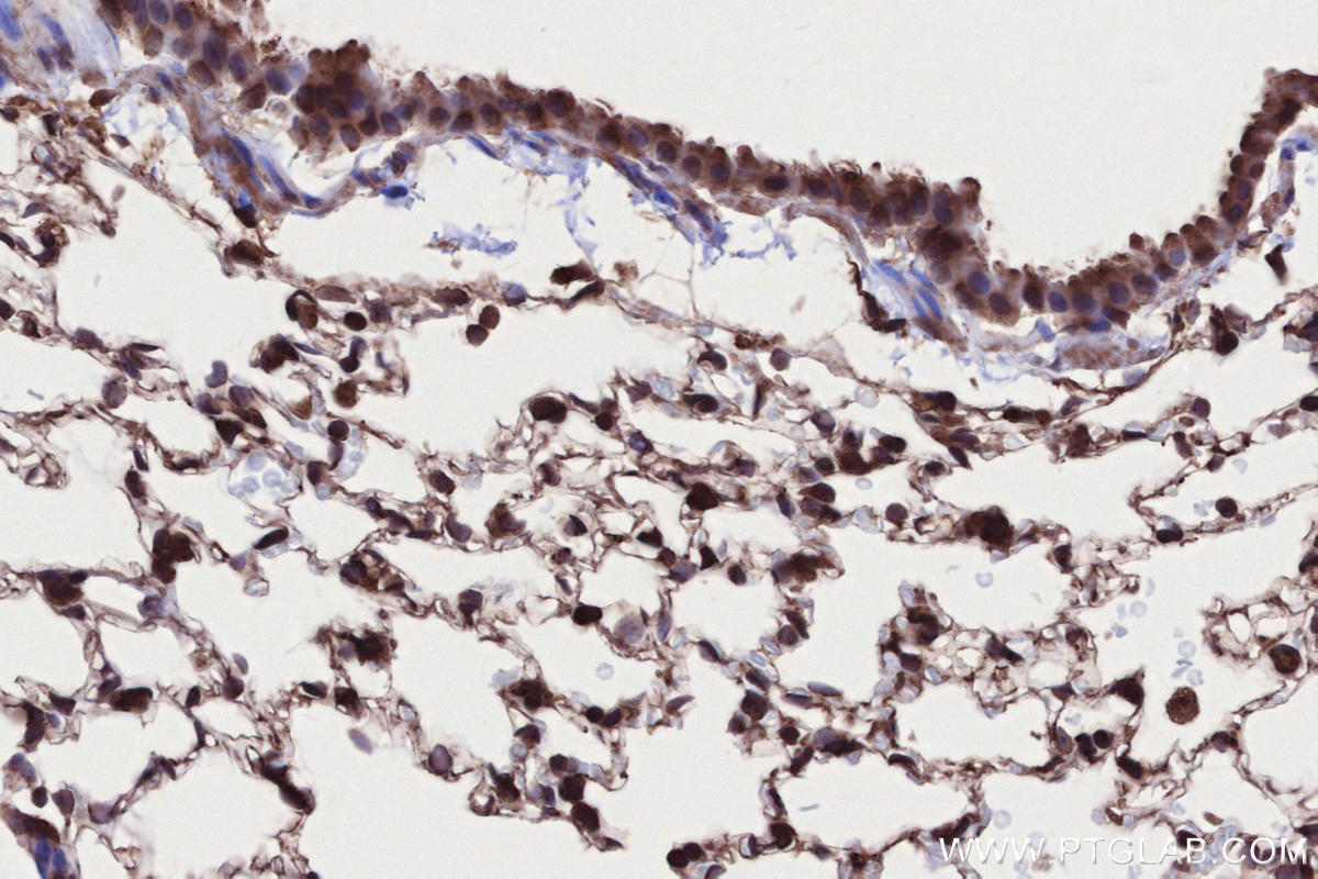 IHC staining of mouse lung using 13624-1-AP IHC staining of mouse lung using 13624-1-AP