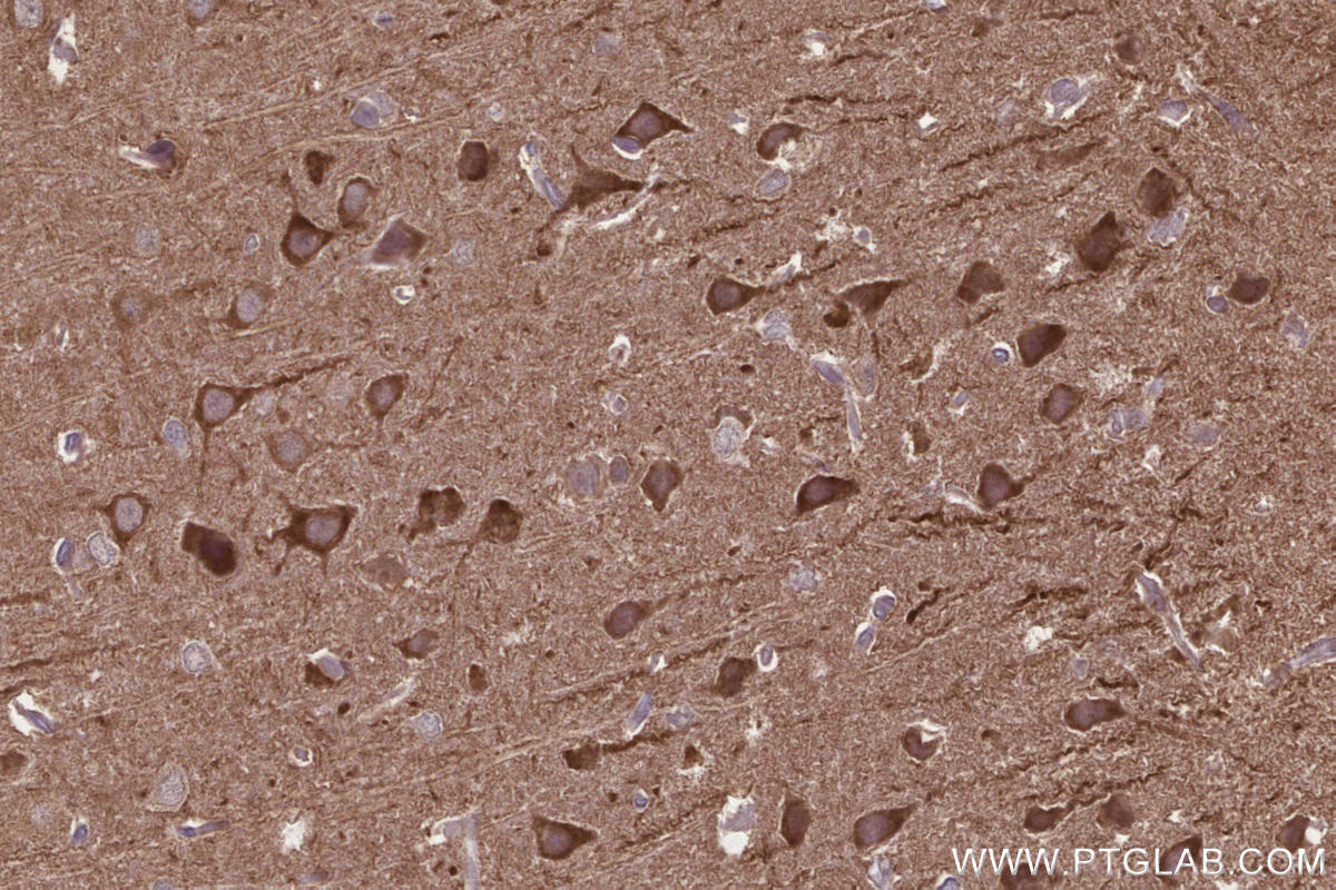 IHC staining of rat brain using 13624-1-AP IHC staining of rat brain using 13624-1-AP