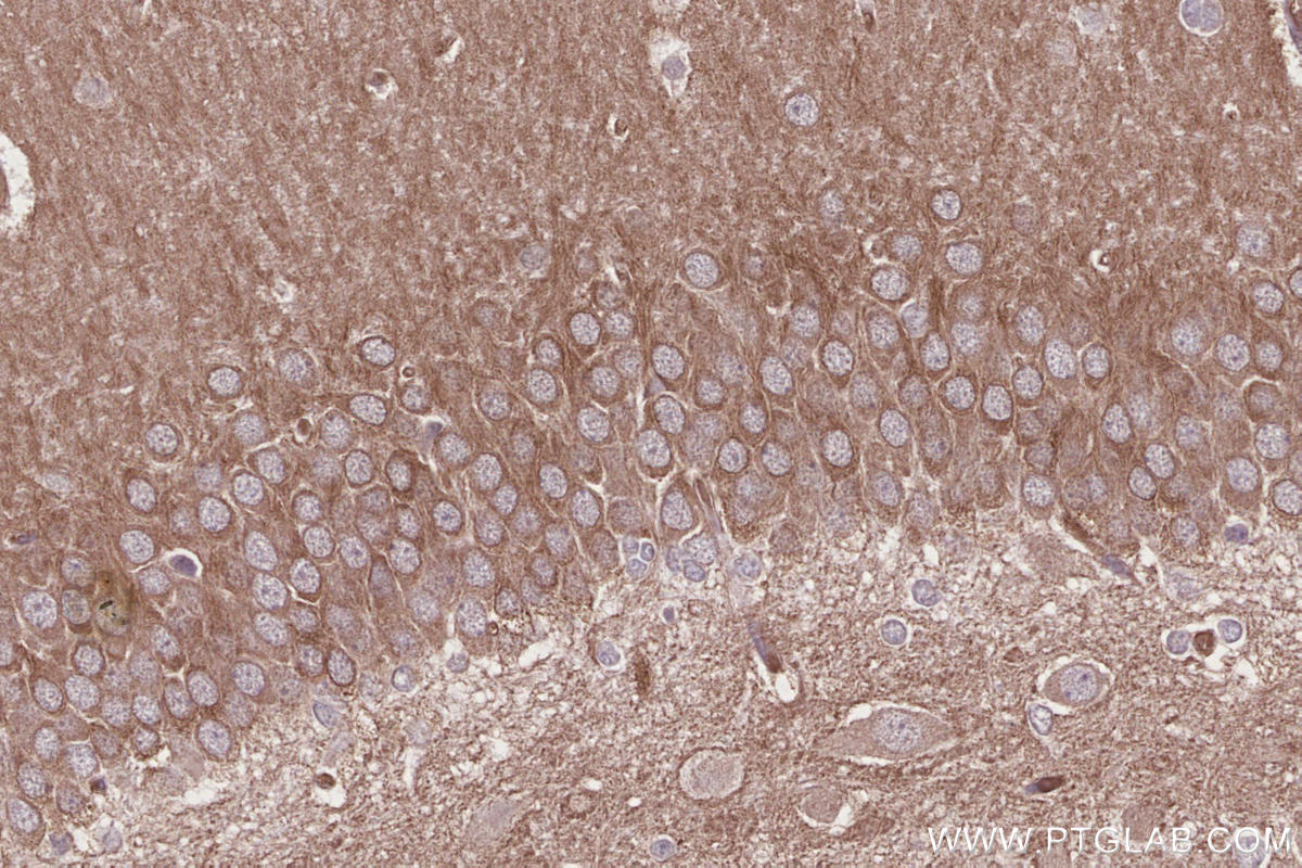 IHC staining of rat brain using 13624-1-AP IHC staining of rat brain using 13624-1-AP