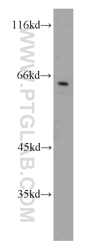 WB analysis of Jurkat using 13624-1-AP