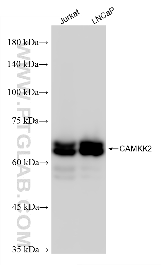 Various lysates were subjected to SDS PAGE followed by western blot with 82720-14-RR (CAMKK2 antibody) at dilution of 1:10000 incubated at room temperature for 1.5 hours. WB analysis using 82720-14-RR