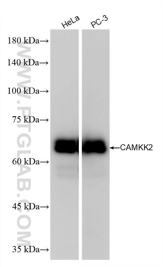 Various lysates were subjected to SDS PAGE followed by western blot with 82720-14-RR (CAMKK2 antibody) at dilution of 1:10000 incubated at room temperature for 1.5 hours. WB analysis using 82720-14-RR