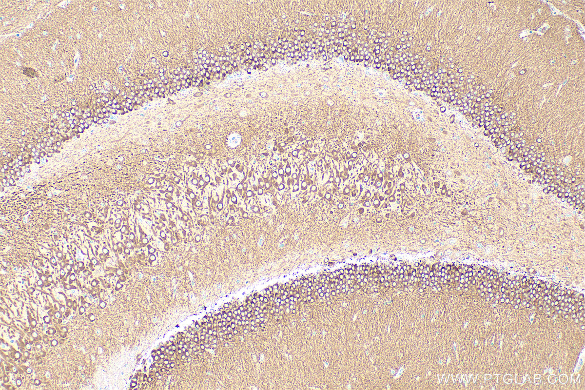 IHC staining of rat brain using 14788-1-AP